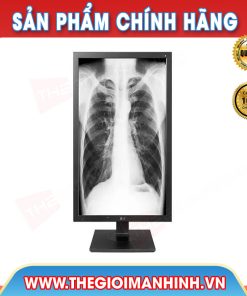 Màn hình hiển thị kết quả LG 21HK512-D